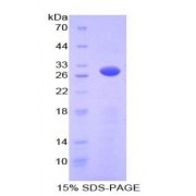 SDS-PAGE analysis of Mouse PRKAg2 Protein.