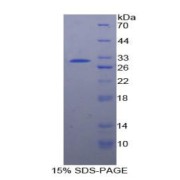 SDS-PAGE analysis of Human PTPRJ Protein.