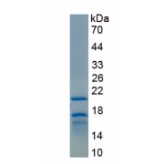 SDS-PAGE analysis of Human Proteinase 3 Protein.