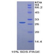 SDS-PAGE analysis of Rat Pyridoxal Kinase Protein.