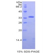 SDS-PAGE analysis of Human PDHb Protein.