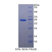 SDS-PAGE analysis of Human PK Protein.