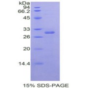 SDS-PAGE analysis of Human RORa Protein.