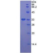 SDS-PAGE analysis of Human RORg Protein.