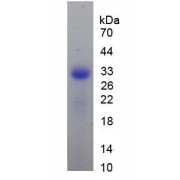 SDS-PAGE analysis of Mouse RANk Protein.