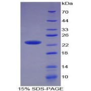 SDS-PAGE analysis of Human TNFSF11 Protein.