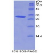SDS-PAGE analysis of Mouse ROR1 Protein.