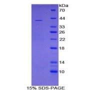 SDS-PAGE analysis of Mouse Reelin Protein.