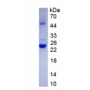 SDS-PAGE analysis of recombinant Human Relaxin 2 Protein.