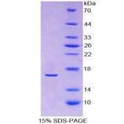 SDS-PAGE analysis of recombinant Human RXFP1 Protein.