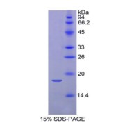 SDS-PAGE analysis of Mouse RBP2 Protein.