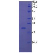 SDS-PAGE analysis of Cow RBP4 Protein.