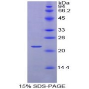 SDS-PAGE analysis of Chicken RBP4 Protein.