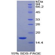 SDS-PAGE analysis of Cow RBP5 Protein.