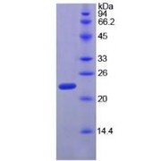 SDS-PAGE analysis of Rat Ribonuclease P Protein.