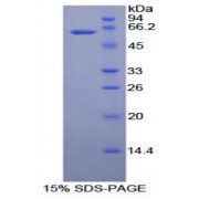 SDS-PAGE analysis of recombinant Human Ribonuclease T2 Protein.