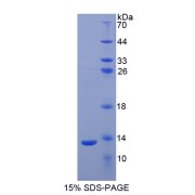 SDS-PAGE analysis of Human S100A2 Protein.