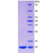 SDS-PAGE analysis of Human S100A7 Protein.