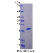 SDS-PAGE analysis of Cow S100A8 Protein.