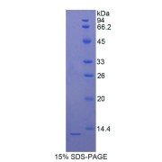 SDS-PAGE analysis of recombinant Rat S100B Protein.