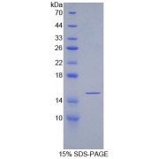 SDS-PAGE analysis of Rat SFRP5 Protein.