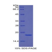 SDS-PAGE analysis of Human Selectin, Platelet Protein.