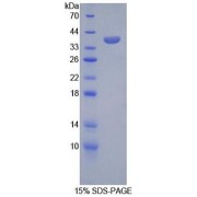 SDS-PAGE analysis of recombinant Human SPINK1 Protein.