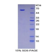 SDS-PAGE analysis of Mouse SPINK5 Protein.