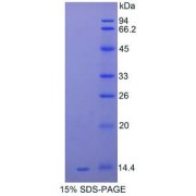 SDS-PAGE analysis of recombinant Mouse Serum Amyloid A Protein.