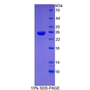 SDS-PAGE analysis of Human SHBG Protein.