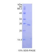 SDS-PAGE analysis of Human SIGLEC1 Protein.