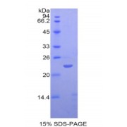 SDS-PAGE analysis of Human SIGLEC12 Protein.