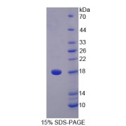 SDS-PAGE analysis of Human STAT5A Protein.