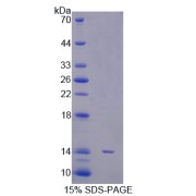 SDS-PAGE analysis of Human STAT5A Protein.