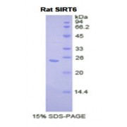 SDS-PAGE analysis of Rat Sirtuin 6 Protein.