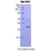 SDS-PAGE analysis of Rat Slit Homolog 1 Protein.