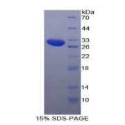 SDS-PAGE analysis of Human SSFA2 Protein.