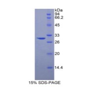 SDS-PAGE analysis of Human Sphingosine Kinase 1 Protein.