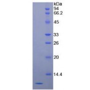 SDS-PAGE analysis of Human SCCA2 Protein.