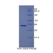 SDS-PAGE analysis of Mouse SCFR Protein.