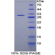 SDS-PAGE analysis of Human Stratifin Protein.