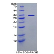 SDS-PAGE analysis of Mouse Stratifin Protein.