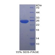 SDS-PAGE analysis of Rat SDF4 Protein.