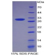 SDS-PAGE analysis of recombinant Rat SOD3 Protein.