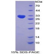 SDS-PAGE analysis of Mouse CCS Protein.
