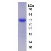 SDS-PAGE analysis of Human ST14 Protein.