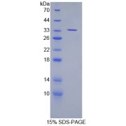 SDS-PAGE analysis of Mouse SUV420H2 Protein.