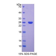 SDS-PAGE analysis of recombinant Rat Surfactant Associated Protein B SPB Protein.