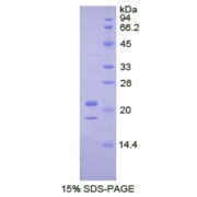 SDS-PAGE analysis of recombinant Human TARDBP Protein.