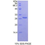 SDS-PAGE analysis of recombinant Mouse TIGIT Protein.